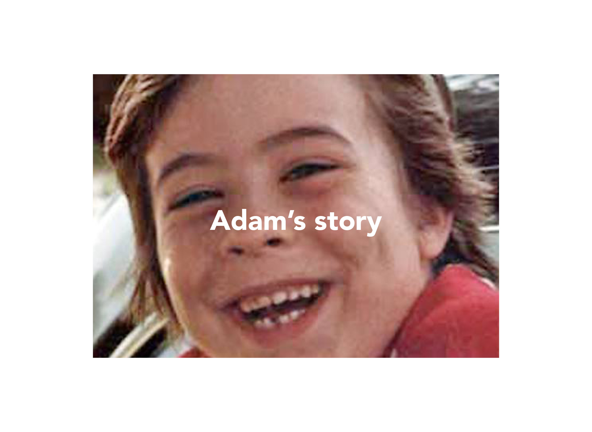 close up of adam's face, smiling, missing bottom tooth